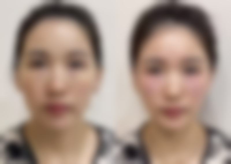 【广州和谐整形美容医院特色项目：】