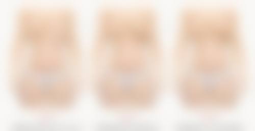 美容院的除皱有什么副作用么