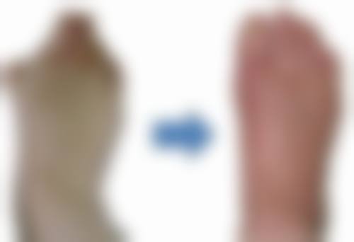 瘦脸针的价格及适用人群