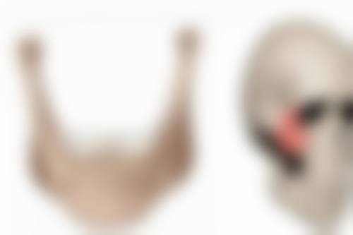 川字纹:玻尿酸还是除皱针?