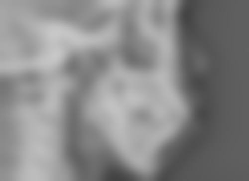 如何避免打完瘦脸针出现这些问题