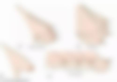 什么面膜除皱效果最好？揭秘医美界公认的3款高效除皱面膜，让你轻松告别皱纹！ 