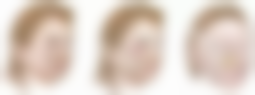 玻尿酸丰太阳穴一针保持多久？了解影响时长因素，掌握3大秘诀让效果维持1-2年不是梦！ 