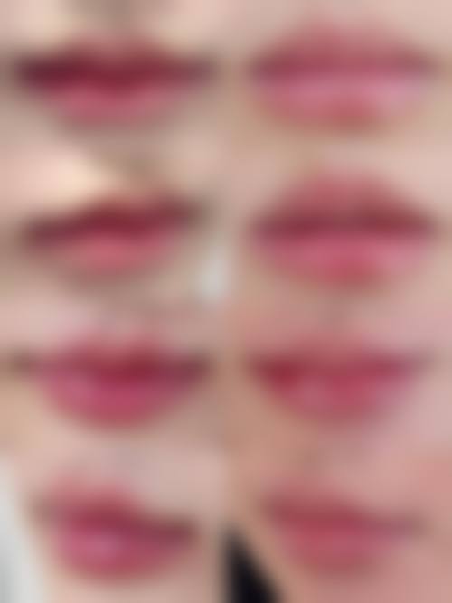 【昆明亿美倩整形医院特色项目：】