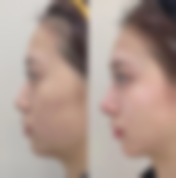 【南京天际医疗美容诊所怎么预约挂号?】