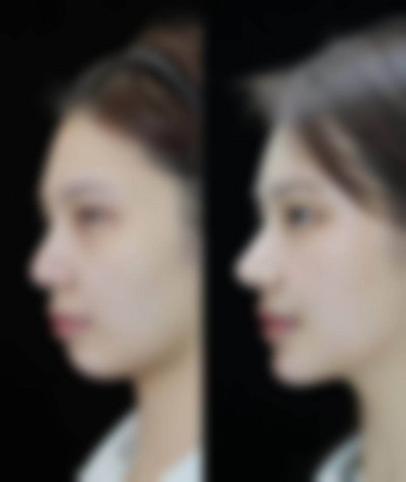 【郑州代淑媛医疗美容门诊部参考价格表：】