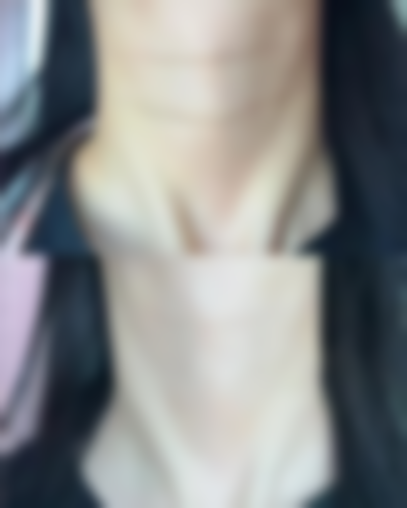 瘦脸针打完多久见效