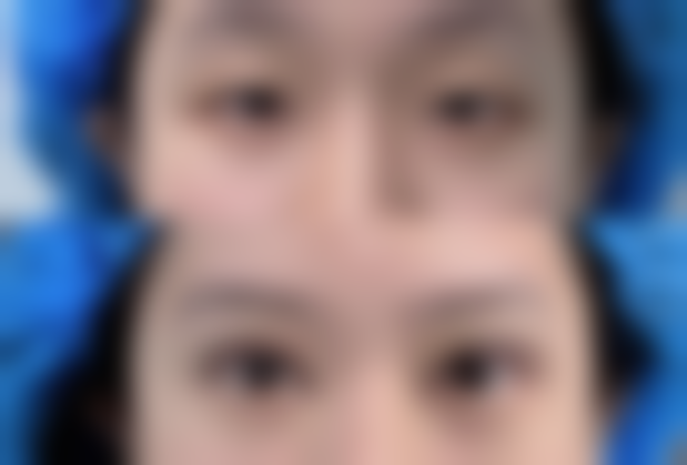 【昆明亿美倩整形医院是正规的吗?】