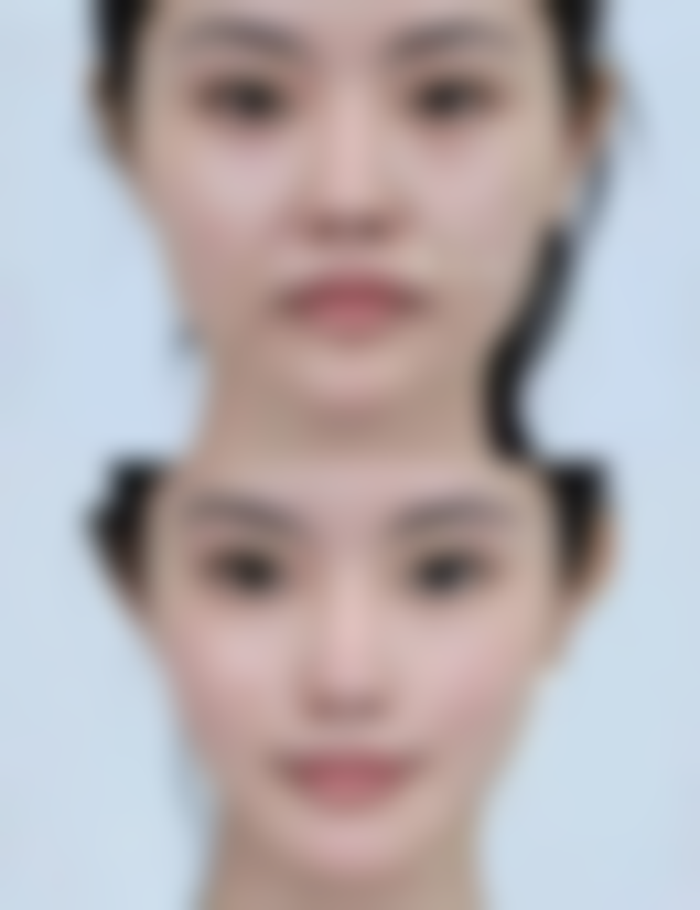 【韩国Qline整形外科患者口碑评价:】