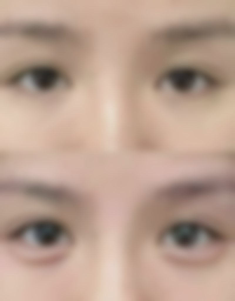 【福州亚美医疗美容诊所特色项目：】