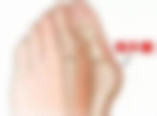 微针植发的优点