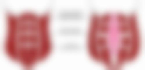 发际线种植多少钱