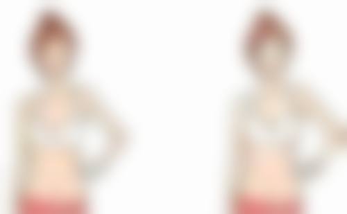 微针植发的成活率