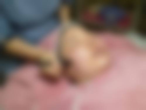 武汉涵美整形特邀王伟民医生技术怎么样