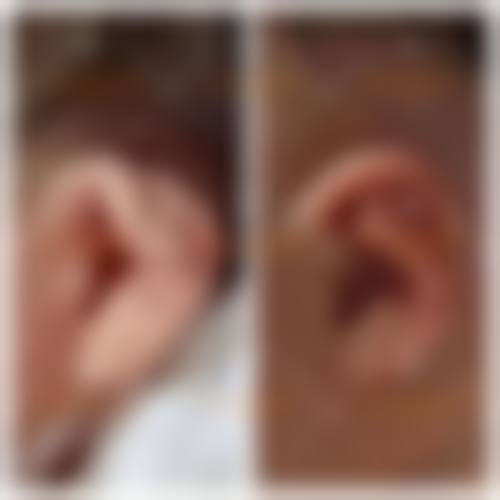 【廊坊华康整形医院是正规的吗?】