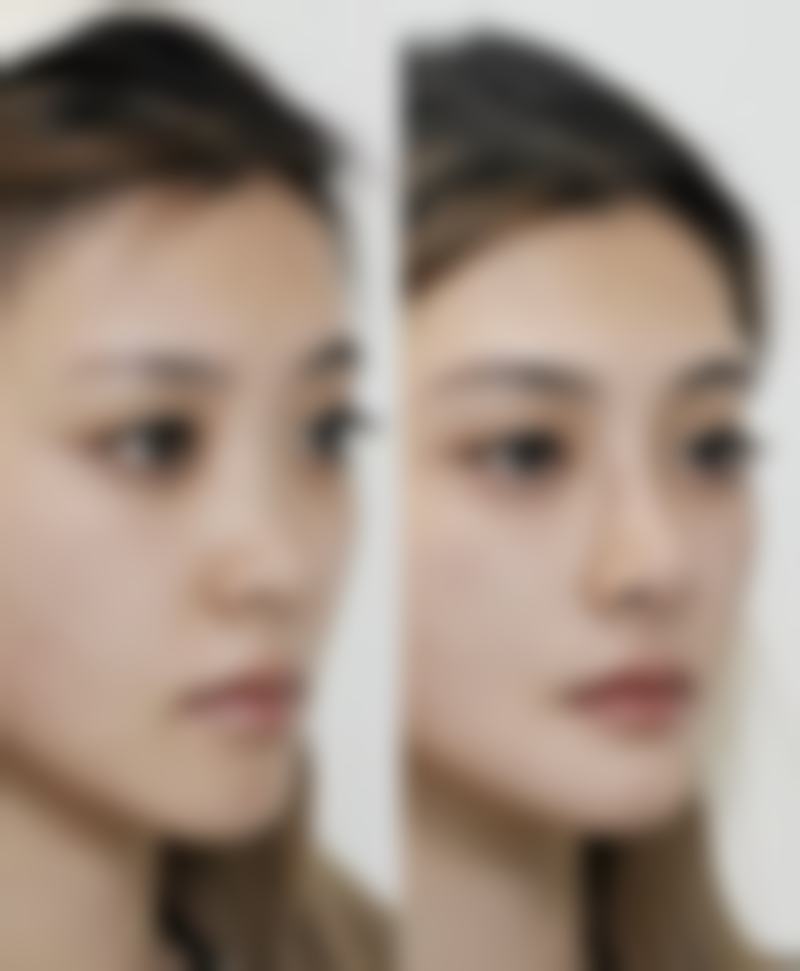 【清徐缪熙整形医院患者口碑评价：】