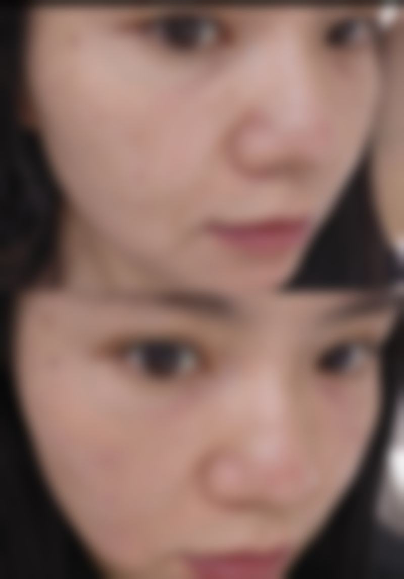 【益阳爱思特医疗美容医院有限公司参考价格表：】