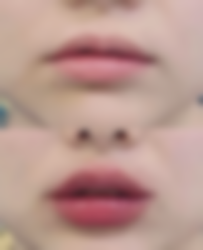 怎么自我改善凸嘴