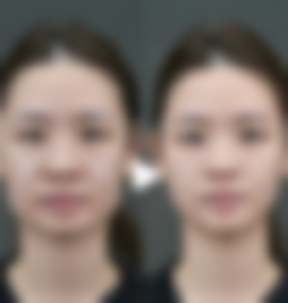 唇部整形美容医院大盘点