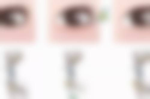 三、脸部打除皱针有副作用吗