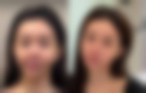 种植发会长长吗,种植的头发是不是长不长,种植的头发可以长吗?