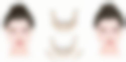 种植的头发都能成活吗?