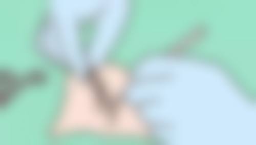 脸部打除皱针有什么危害？了解这5大潜在风险，教你正确应对让美丽与安全同行！ 