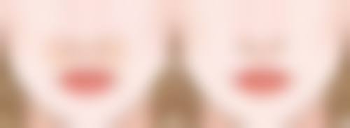 种植的发可以长长吗？揭秘植发后头发正常生长的关键因素及护理秘籍，让你轻松拥有浓密秀发！ 