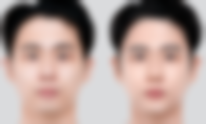 【重庆康和美整形医院患者口碑评价：】