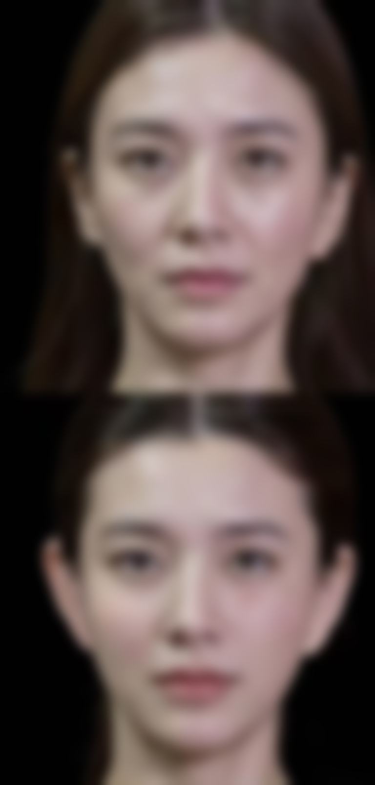 【河南科技大学第一附属医院(烧伤整形外科)参考价格表：】