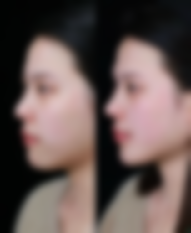 种发能不能长,种植的头发能生长吗?