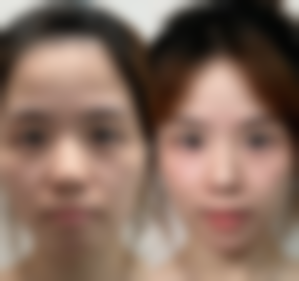 虽然目前没有具体的医生名字信息，但可以知道这家医院拥有经验多的医生团队。这些医生们在医疗美容领域深耕多年，积累了丰富的临床经验。他们能够结合精良的技术和个性化的服务，为每位顾客制定专属的美容方案，确保顾客能获得至佳的美容成效。无论是面部整形、皮肤护理还是植发等项目，医生们都能凭借专精的技能和丰富的经验，为顾客打造满意的变得更美体验。