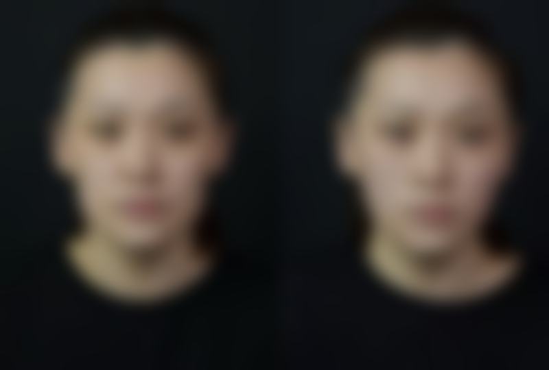 【重庆康和美整形医院是正规的吗?】