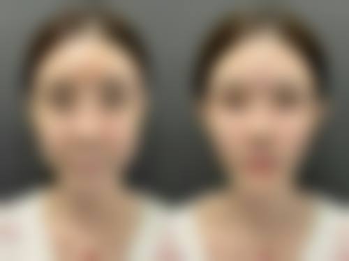 美白针的潜在危害