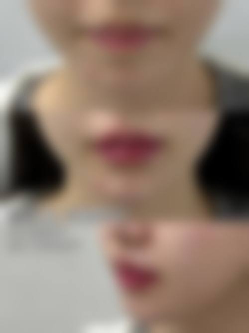 【上海玫瑰医疗美容医院怎么预约挂号?】