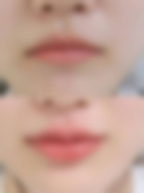 【揭阳榕江医院医疗美容科是正规的吗?】