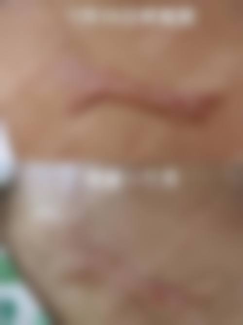 【阜阳利辛县中医院核心优势：】