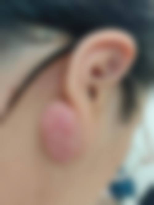 【阜阳利辛县中医院患者口碑评价：】