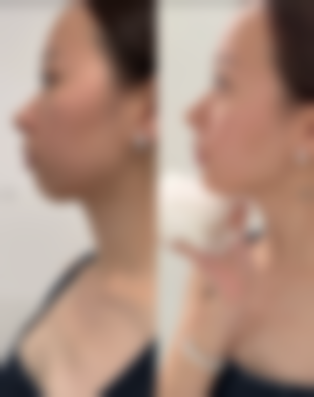 【揭阳榕江医院医疗美容科核心优势：】