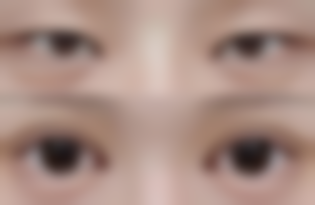 武汉斯启诺医美眼部综合项目的技术优势