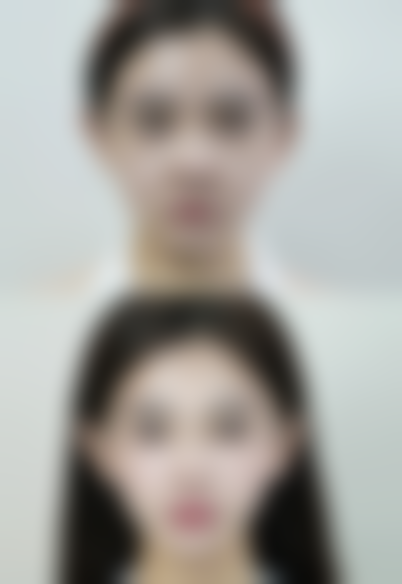 美白针常见问题解答