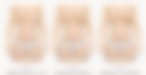 第一次打瘦脸针成效明显吗