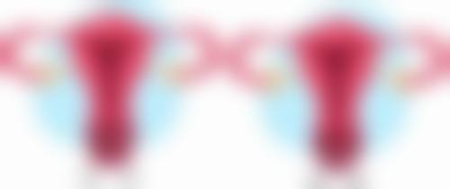 阴道紧缩手术是怎么回事