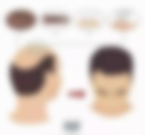 第一次打瘦脸针是不是见效比较慢