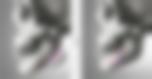 打完瘦脸针没成效怎么回事儿