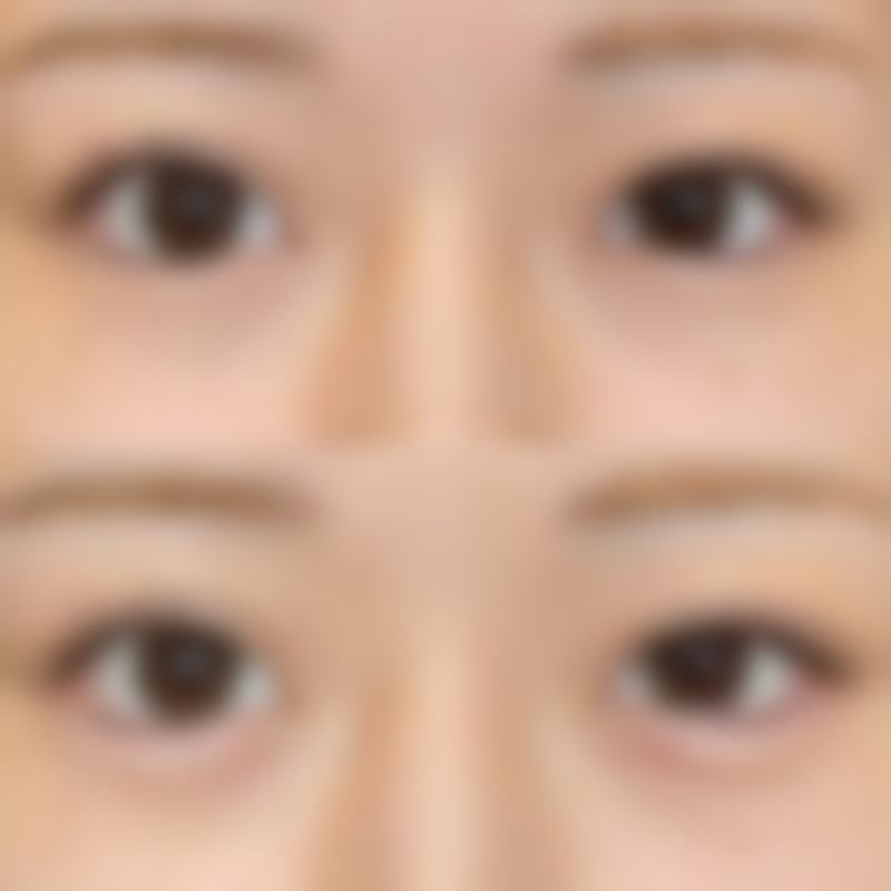 【成都原韩星范医疗美容门诊部参考价格表：】