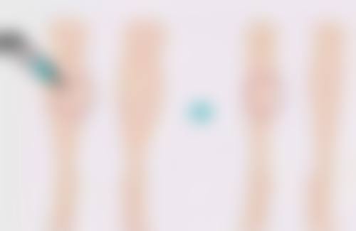 瘦脸针两个月打一次可以吗女生