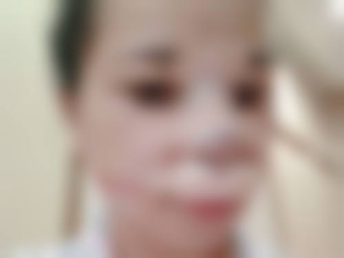 没有毛囊能种植头发吗?