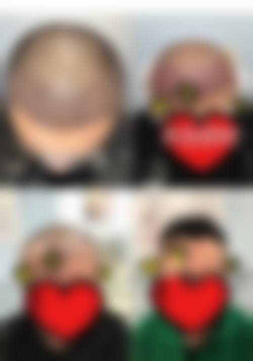 【大连市中山区华医医疗美容诊所参考价格表：】