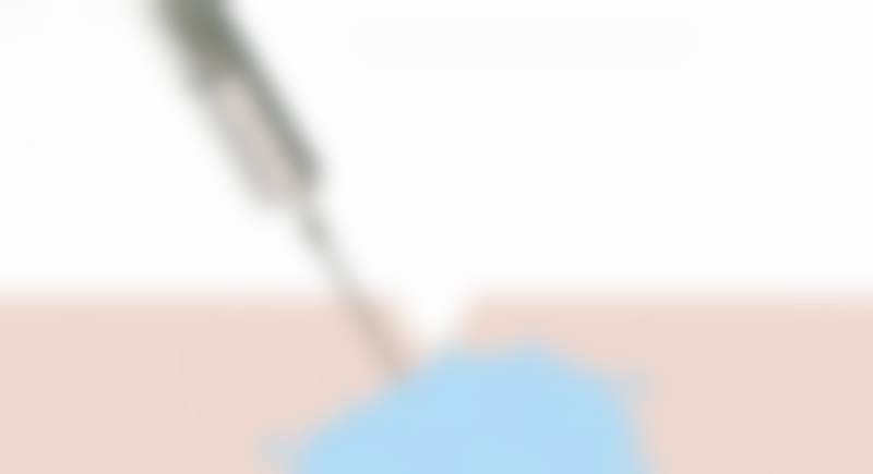 【程飞医生口碑】